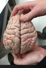 <p>Sensory receptros for touch</p>