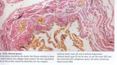 <p>Stain used to differentiate collagen (red) from elastic fibers and muscle (yellow).</p>