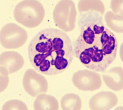 <p>How many lobes must a neutrophil have in order to be considered hypersegmented?</p>