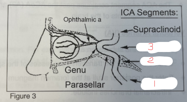 <p>What segment of the ICA is #2?</p>