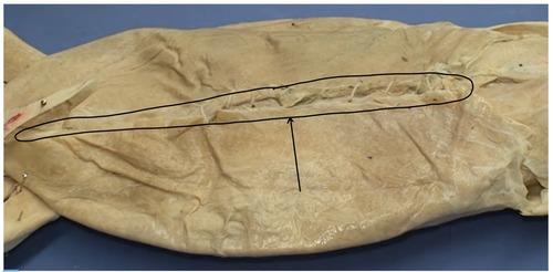 <p>What is this? (it is connective tissue, not muscle)</p>