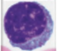 <p>lymphocyte</p>