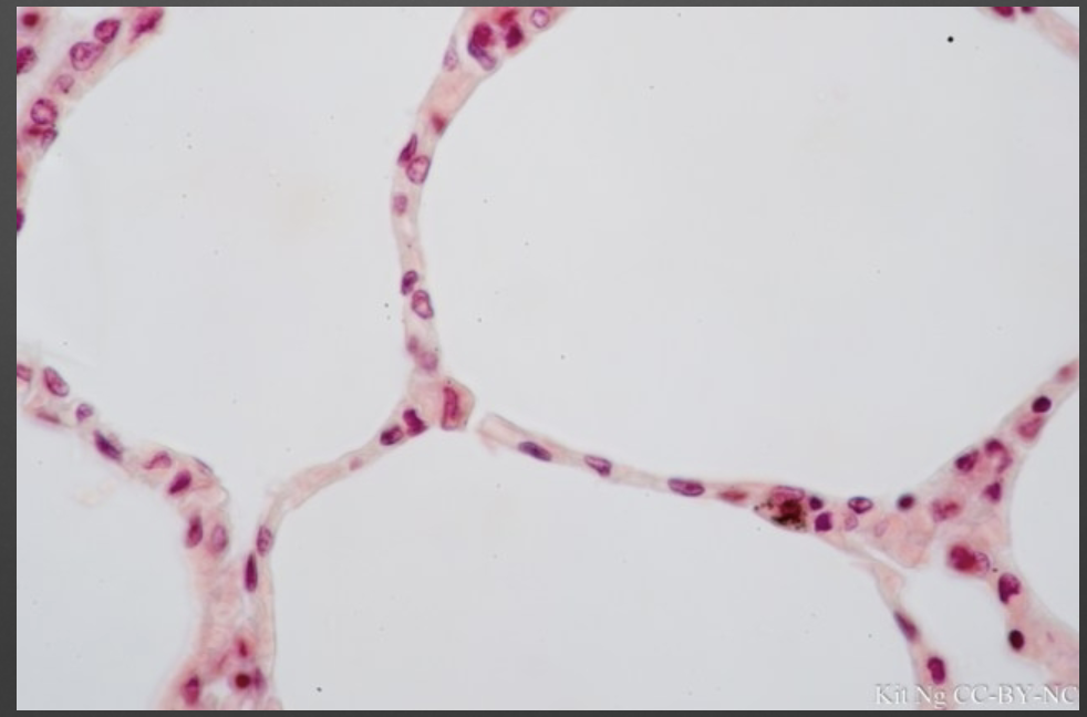 <p>Name this epithelium & give example </p>