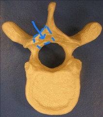 <p>portion of vertebral arch between transverse process & spinous process</p>