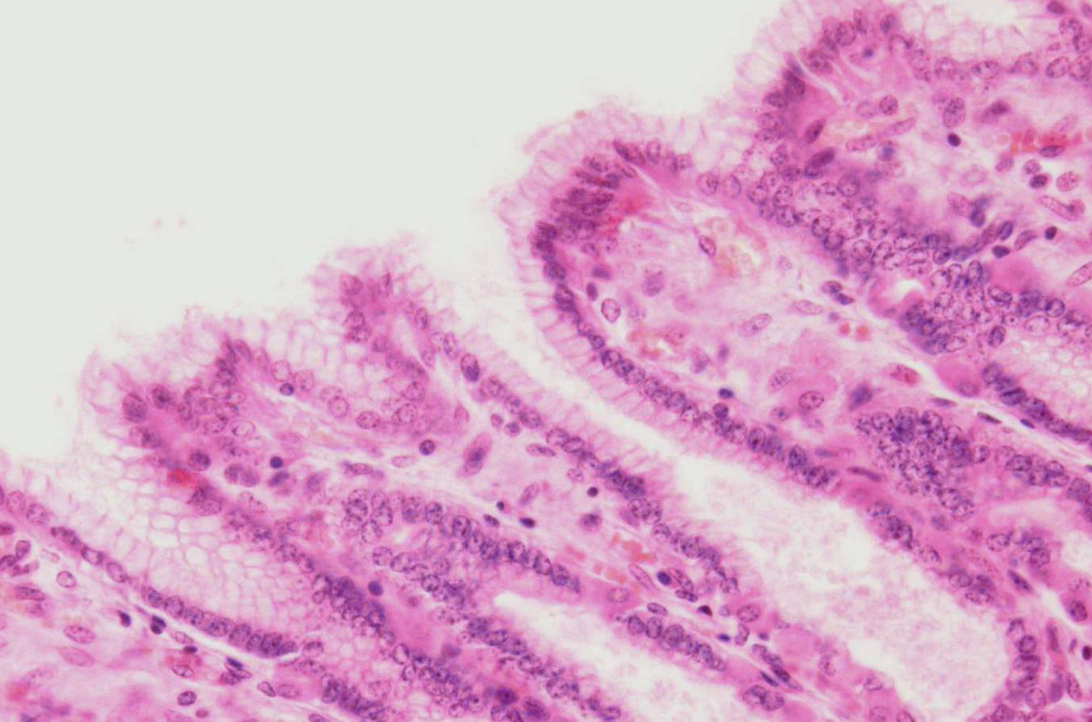 <p>welk soort weefsel en welk preparaat</p>