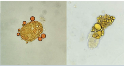 <p>sediment stain</p><p>Oil Red O and Sudan II</p><p>Triglycerides, neutral <strong>fats</strong> and <strong>cholesterol</strong></p>