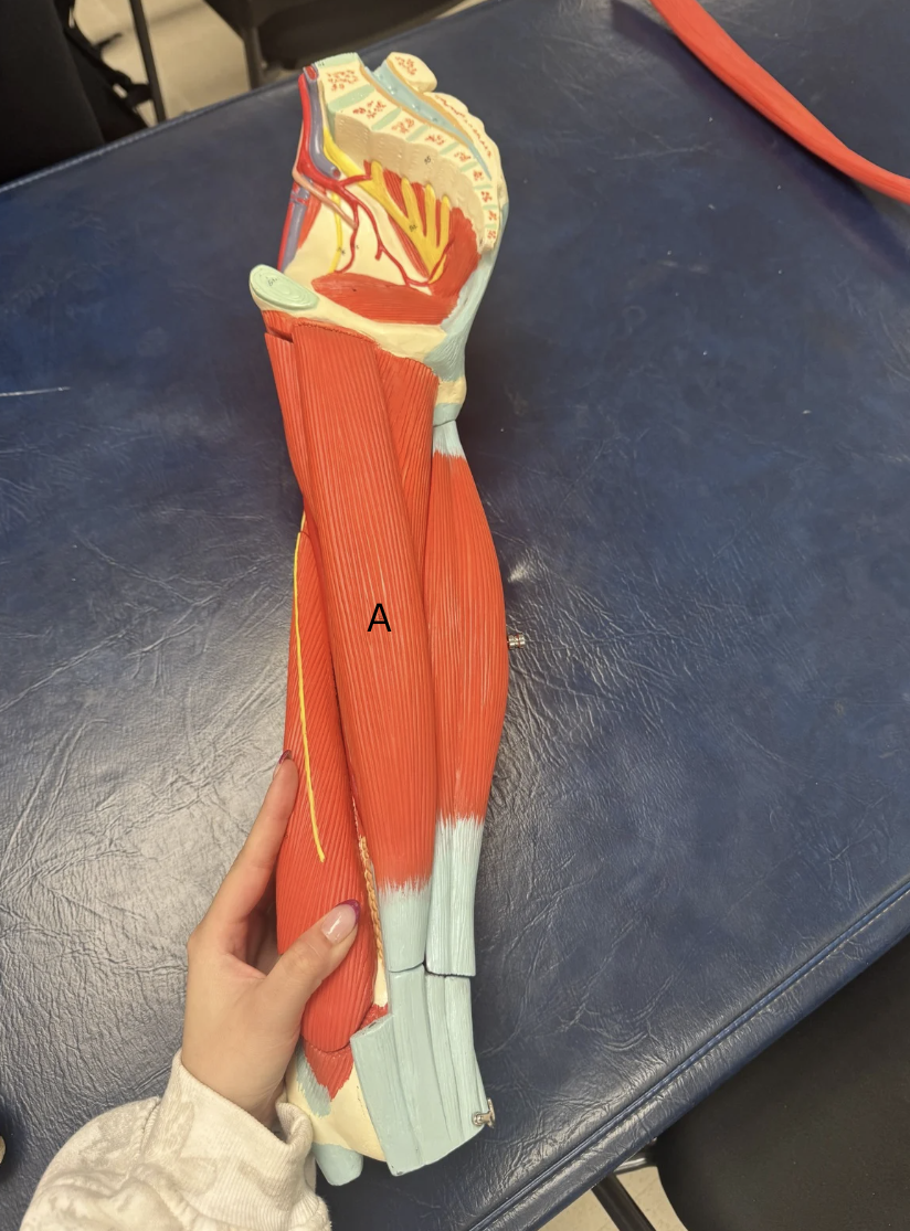 <p>Label this muscle</p>