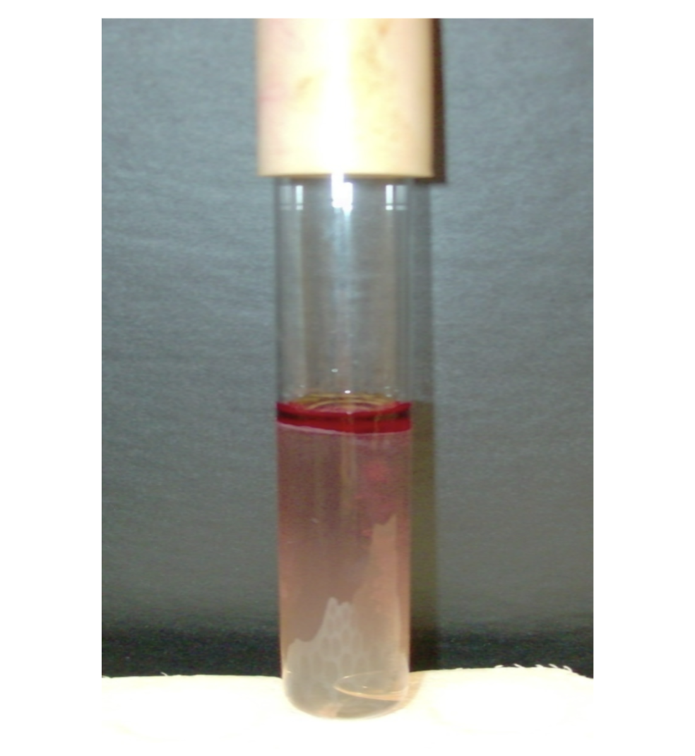 <p>what is the test and result?</p>