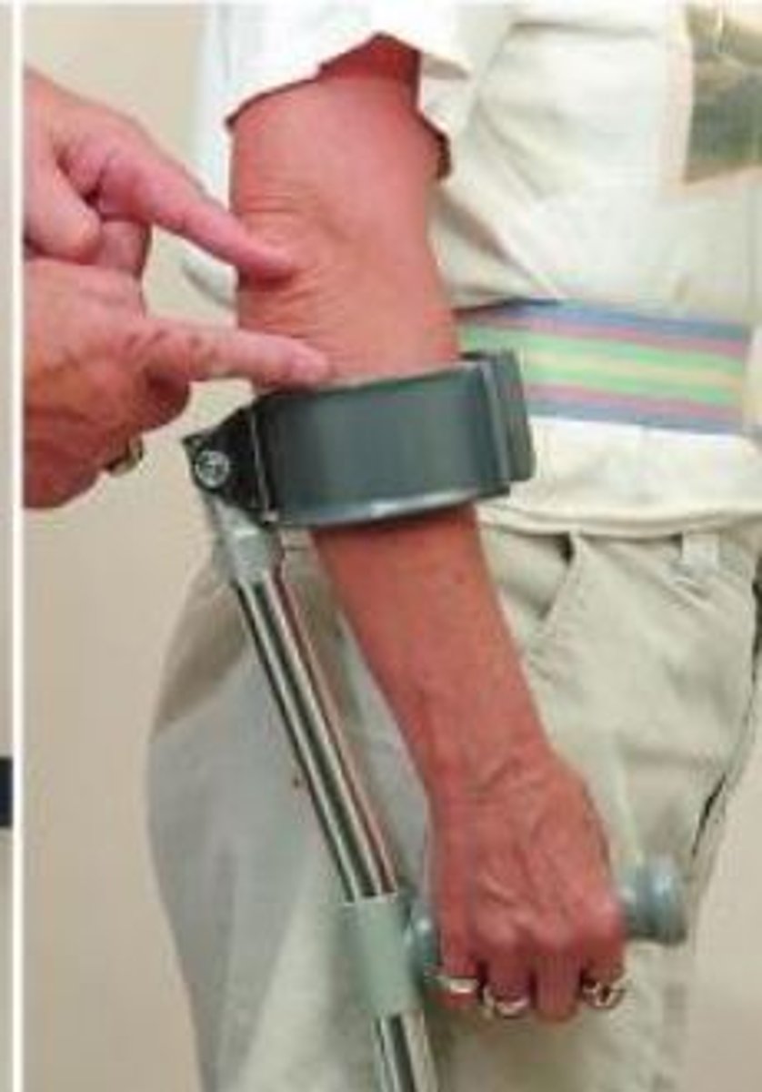 <p>-shorter/more lightweight than axillary crutches</p><p>-more functional in confined spaces</p><p>-promote more upright posture</p><p>-more functional stair climbing method</p><p>-eliminates danger of brachial plexus</p><p>-cuff allows patient to release handles without crutch falling</p><p>-more stability than a cane</p>