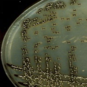 <p>which specialized media for corynebacterium diphtheriae isolation refers to forming black colonies from hydrolysis of tellurite?</p>