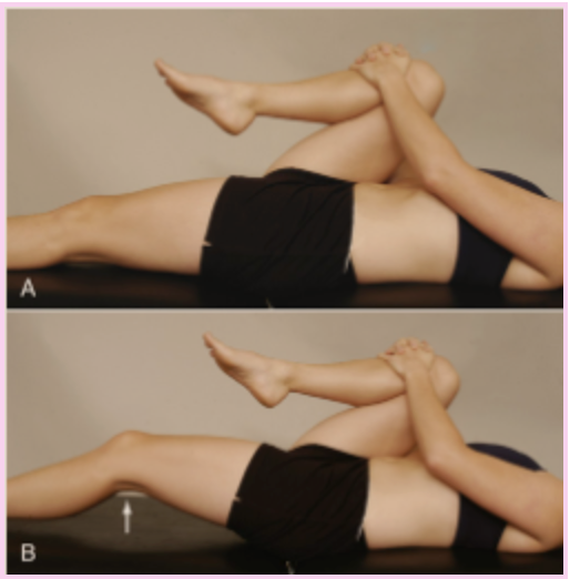<ul><li><p><strong>How:</strong> Patient supine. Flex one hip to the chest to <strong>flatten the lumbar spine and stabilize the pelvis</strong>, while observing the opposite leg.</p></li><li><p><strong>Positive:</strong> <strong>The opposite (straight) leg rises off the table</strong>, indicating a <strong>hip flexion contracture</strong>. If the leg <strong>abducts instead of lifting</strong>, it suggests a <strong>tight iliotibial band (TFL/ITB)</strong>.</p></li></ul><p></p>
