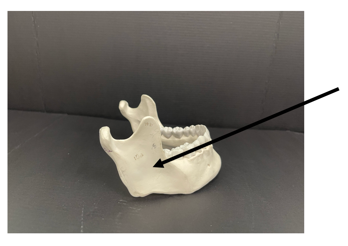 <p>The vertical to oblique/ posterior portion of the mandible is called the_____.</p>