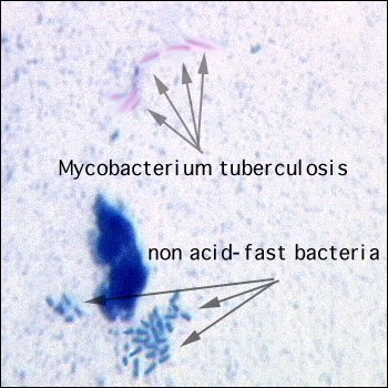 <p>Mycobacterium have a gram-postive cell wall (thick stacked peptidoglycan layer) but it also has a very high lipid content and contains waxes known as <strong>mycolic acids</strong> that gram staining doesn’t work on (hydrophobic).  </p>
