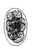 <p>Identify the causative agent</p>