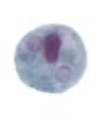 <p>What Amebae is this? Is this the trophozoite or cyst form?</p>
