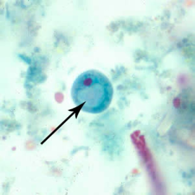 term image