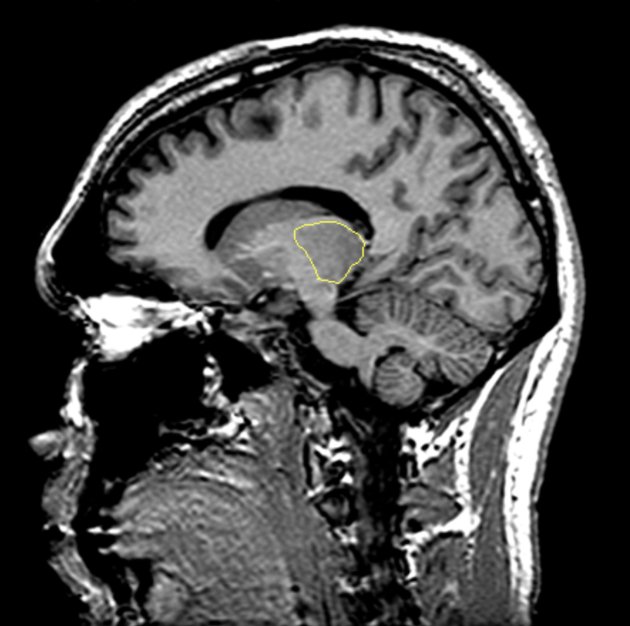 <p>What is the area highlighted called?</p>