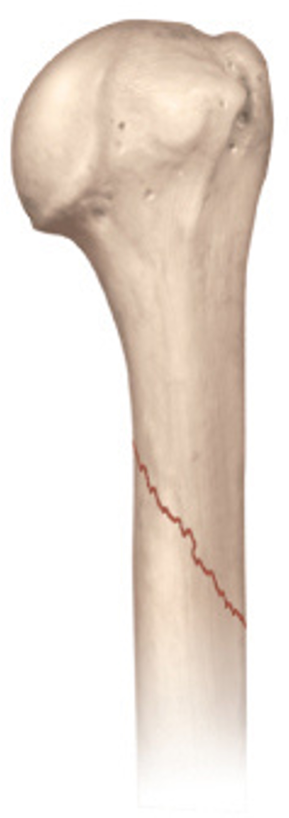 <p>at an ANGLE to the bone shaft</p>