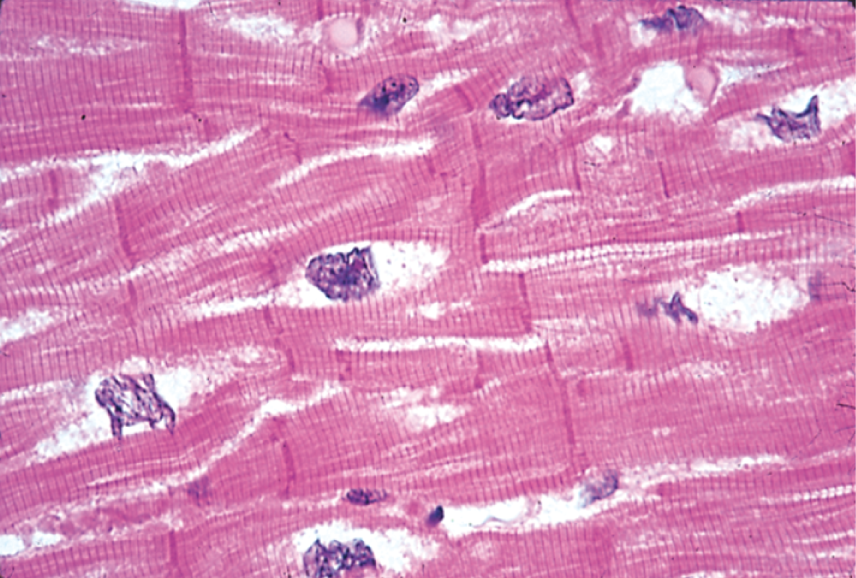 <p><span>Cardiac Muscle</span></p>