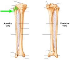 <p>Name Joint</p>