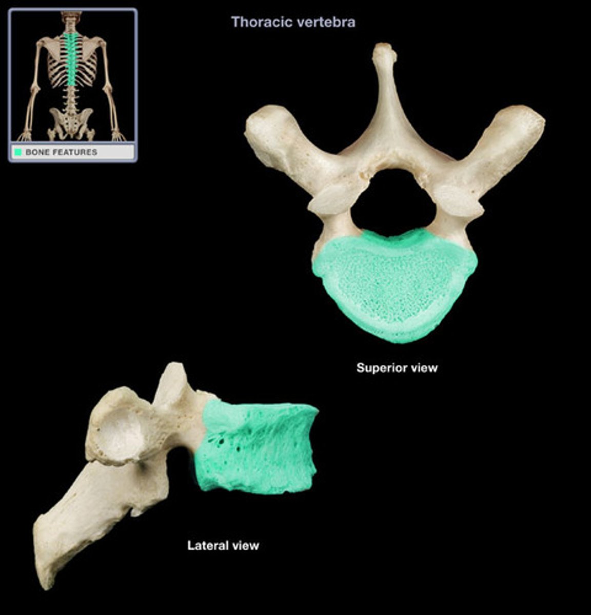 <p>BLANK of the vertebra</p>