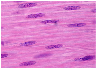 <p>Which muscle type is non-striated, can replicate, and is myogenic?</p>