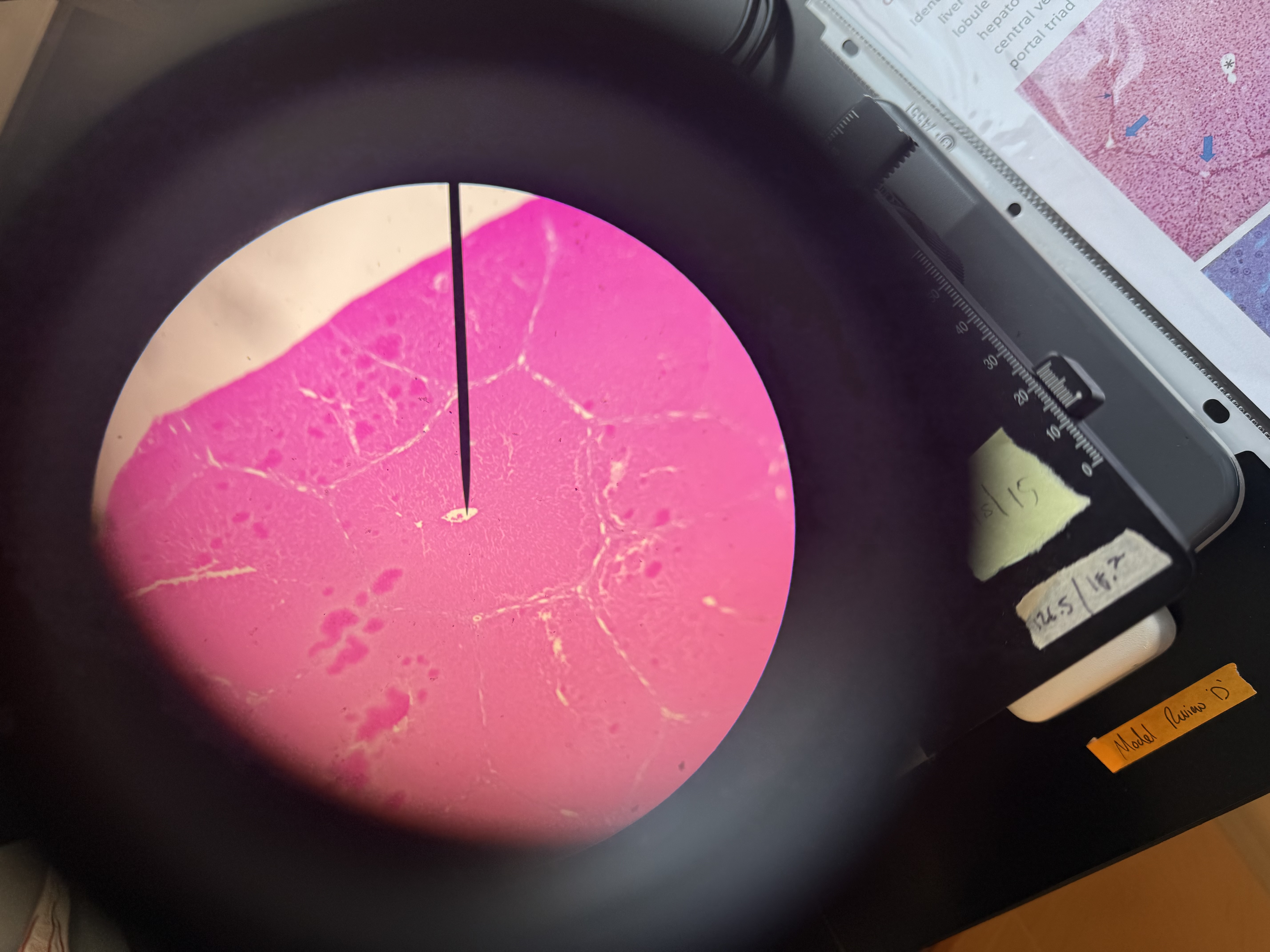 <p>liver histology</p>