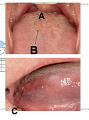 <p>What is B?</p>