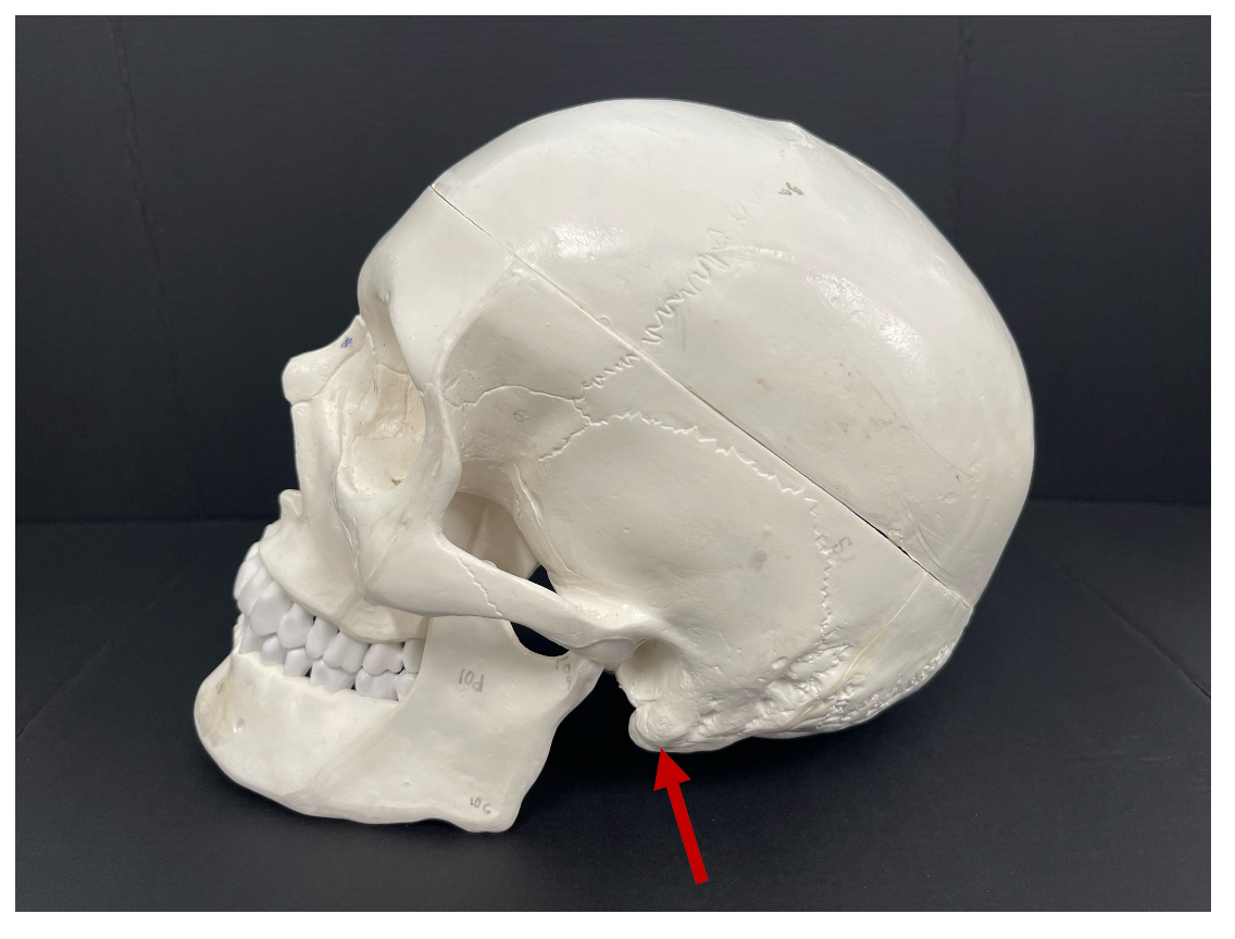 <p>Identify the bony landmark of the temporal bone that the arrow is pointing to.</p>