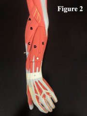 <p>What muscle is A?</p>