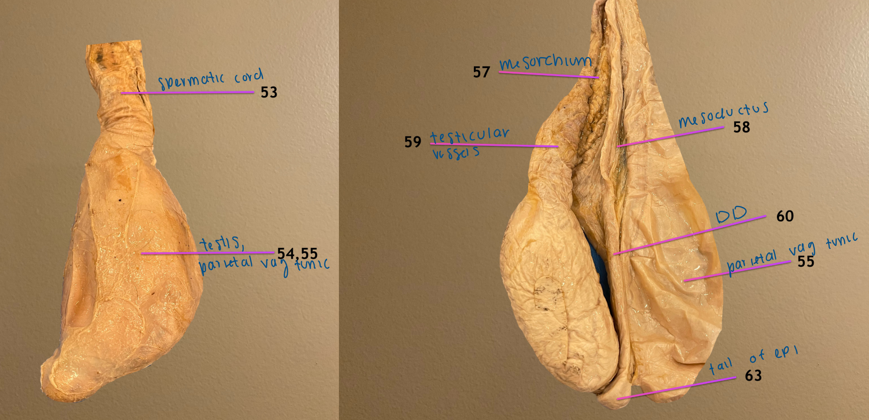 <ol start="53"><li><p>spermatic cord</p></li></ol><ol start="59"><li><p>testicular vessels </p></li><li><p>ductus deferens</p></li></ol><p>.</p><ol start="57"><li><p>mesorchium</p></li><li><p>mesoductus</p></li></ol><p>.</p><p>note: this is bull testicle</p>