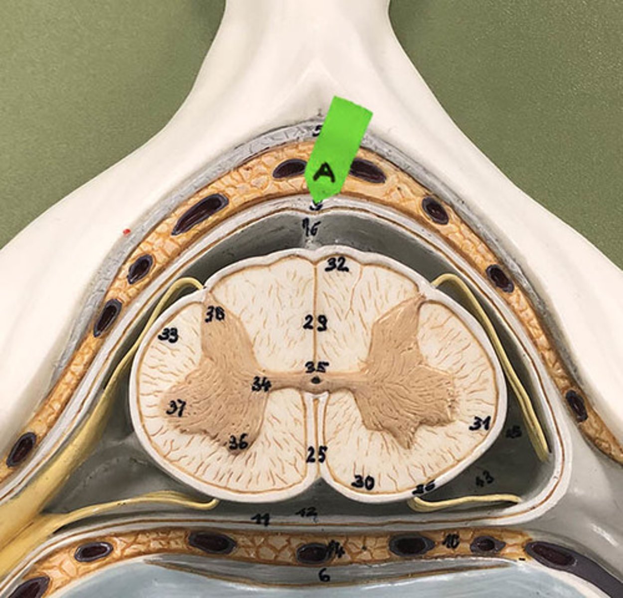 <p>Identify the layer of meninges.</p>