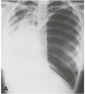 <p><span>Additive Pathology</span></p>
