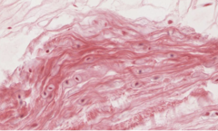 <p>What type of tissue is pictured?</p>