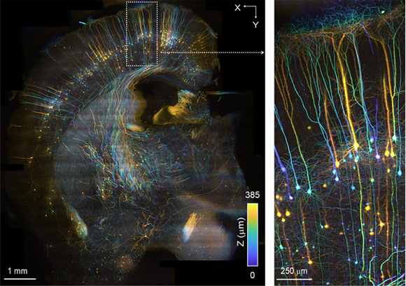 <p>a type of fluorescent microscope, living or dead tissue stained with fluorescent probes</p><p>- Unlike confocal and two-photon that use point-scanning, uses a light sheet to scan the entire specimen</p><p>- Less photobleaching and quicker</p><p>- Great for thicker samples</p><p>- Can be more difficult to prepare, not as commonly used</p>