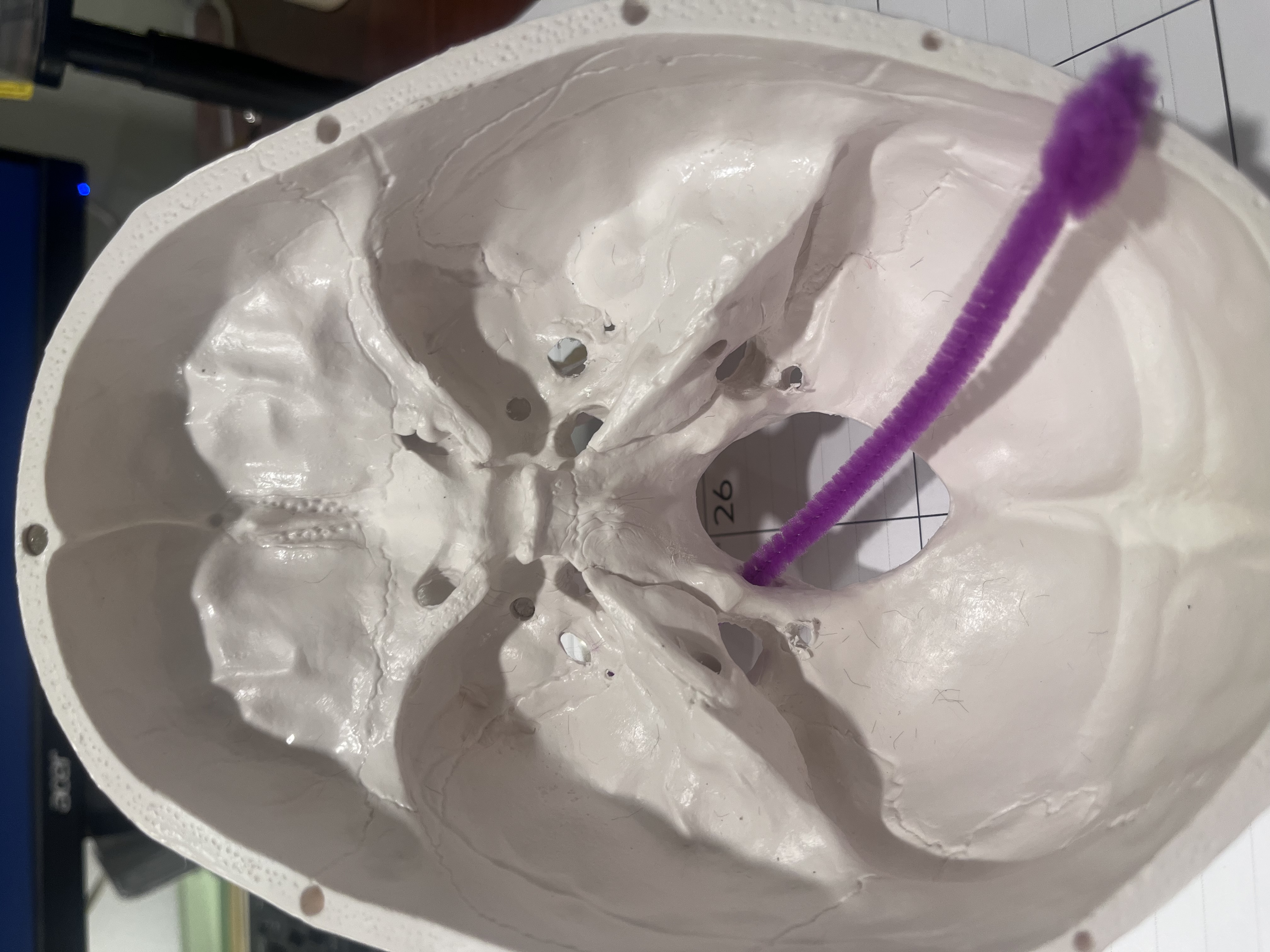 <p>What cranial nerve(s) are represented by the purple pipe cleaner?</p>