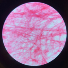 <p>What type of Tissue?</p>