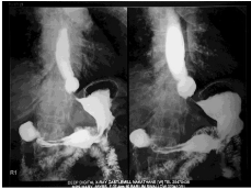 <p>What is the point of a radiology: Upper Gi / Barium Swallow</p>
