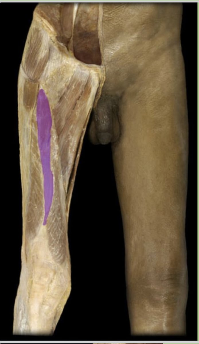 <p>Quadriceps.</p>