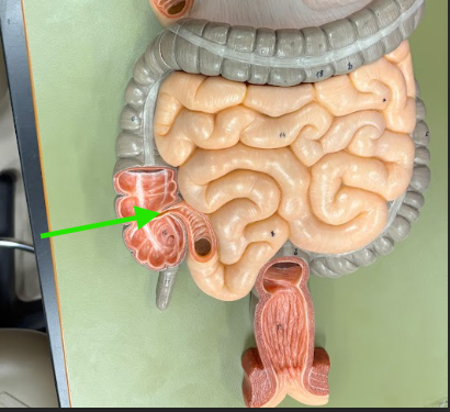 <p>What is the arrow pointing at?</p>