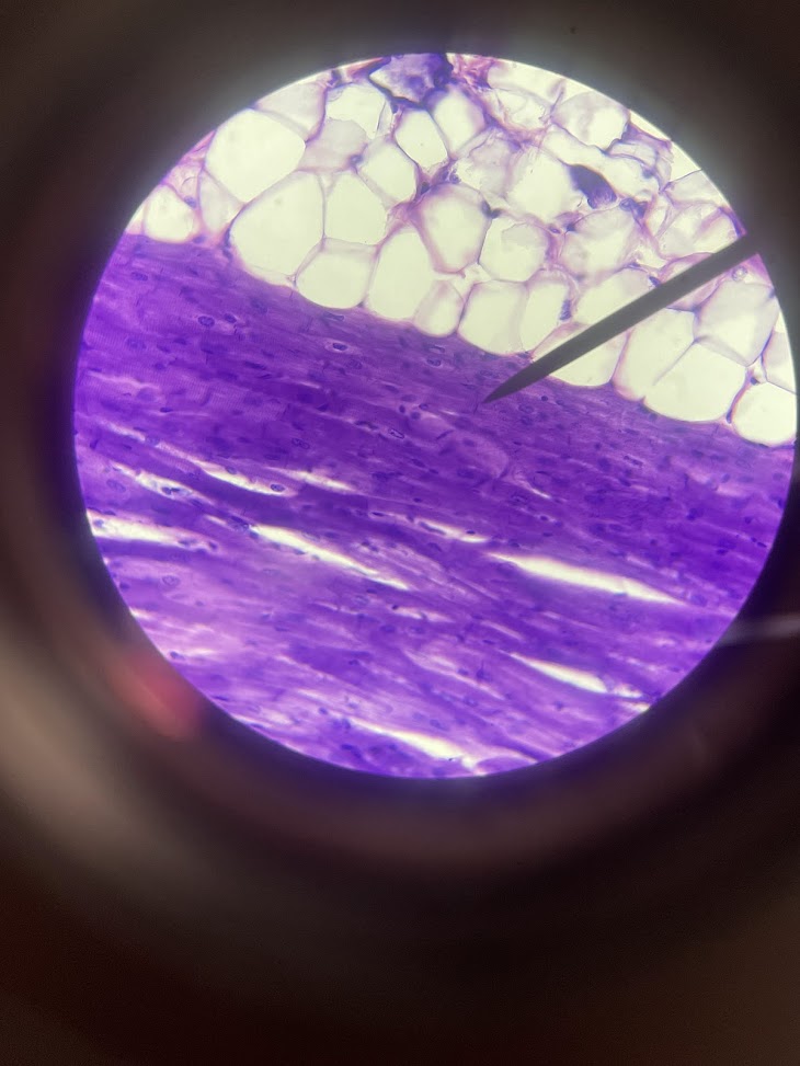 <p>tissue type + structure b/w cells</p>