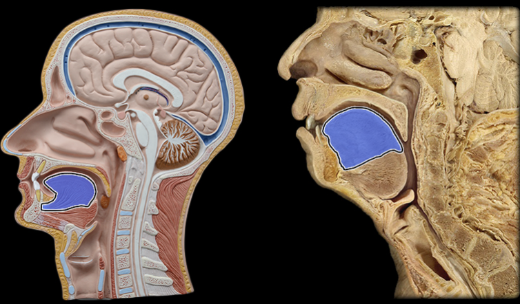 term image