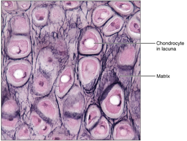<ul><li><p>location: ear</p></li><li><p>function: maintains shape with flexibility </p></li></ul><p>note: only cartilage has chondrocytes </p>