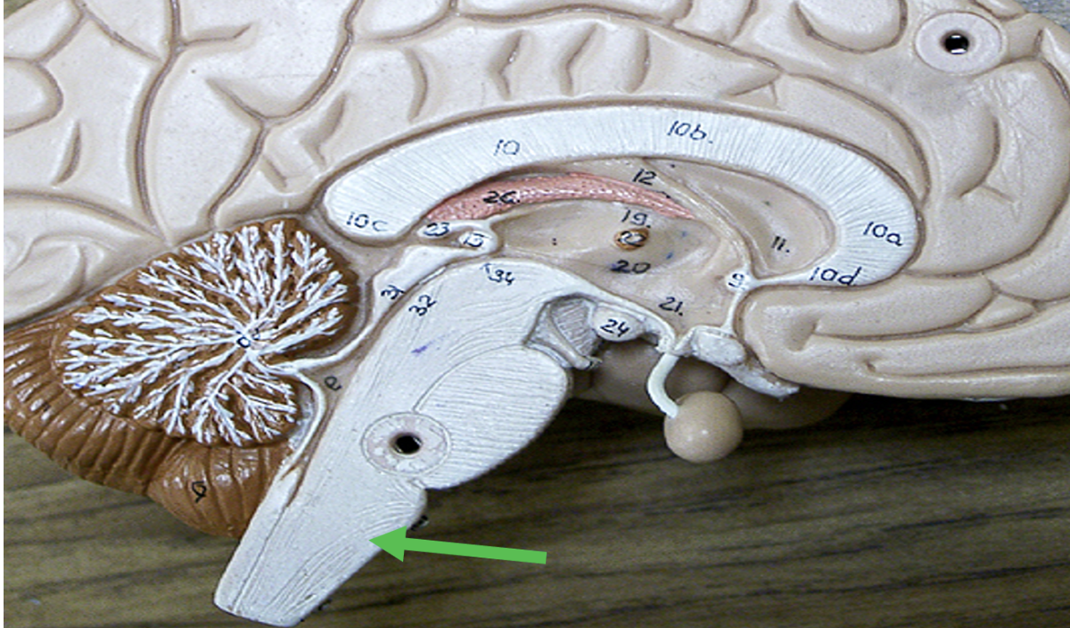 <p><span>Identify the area of the brain indicated by the pointer.</span></p>