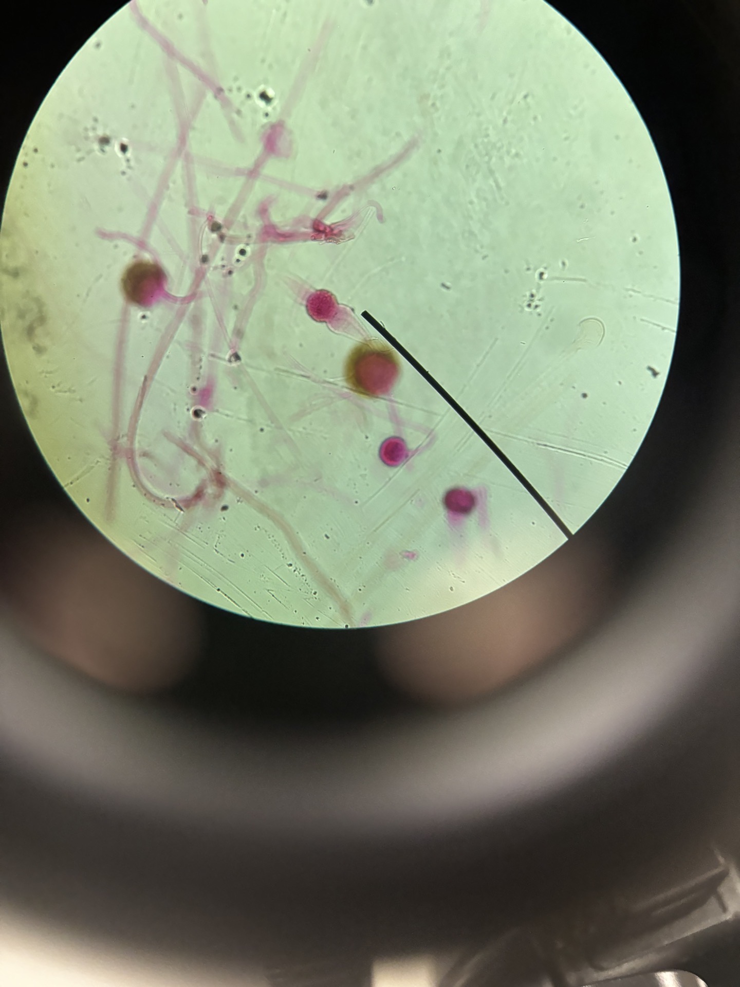 <p>Name this slide, then label mycelium and zygospore.</p>