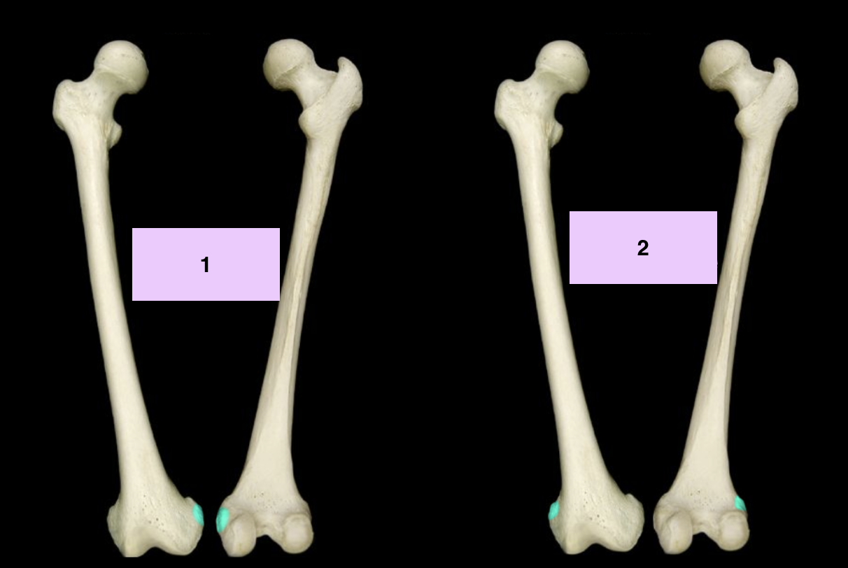 <p>What is 2?</p>