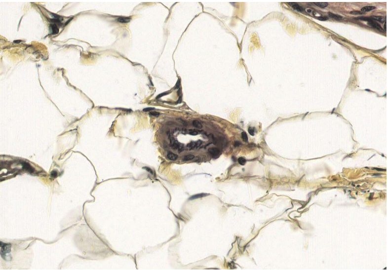 <p>Identify this vessel</p>