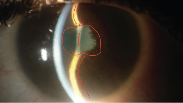 <p>describe and give diagnosis </p>