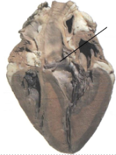 <p><span style="line-height: 17.375px;">Identify the valve&nbsp;</span></p>