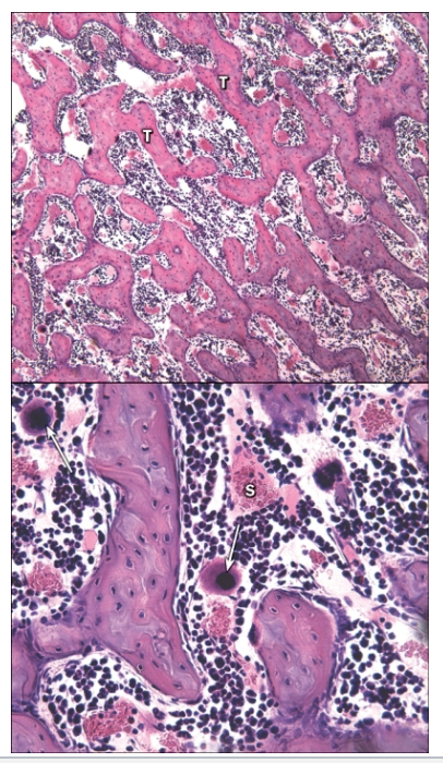 <ul><li><p>In marrow cavity of long bones, between spongy bone trabeculae</p><ul><li><p>Highly vascular; numerous blood sinusoids</p><ul><li><p>Framework of reticular fibers; cells of various types</p></li><li><p>Shifts with age from red to yellow bone marrow</p></li></ul></li><li><p>Responsible for blood cell formation (hemopoiesis)</p></li></ul></li></ul><p></p>